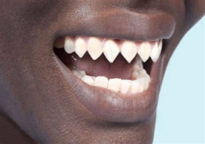 How To Sharpen Your Teeth